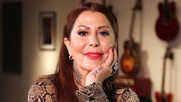 Alejandra Guzmán recordó los problemas de salud que tuvo tras una fallida operación estética.