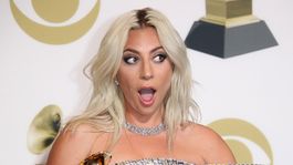 se olvido lo de abajo: la foto de lady gaga que conquisto a todos se olvido lo de abajo: la foto de lady gaga que conquisto a todos
