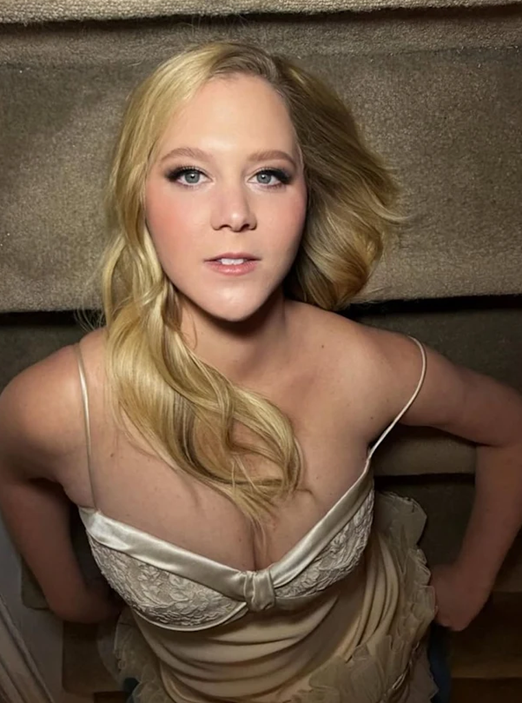 Amy Schumer sorprendió con su transformación Amy Schumer sorprendió con su transformación