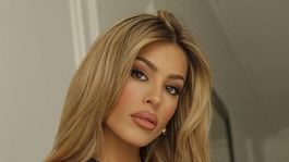 oriana marzoli reaparecio en supervivientes y sorprendio con su retoque estetico