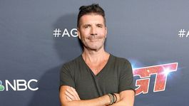 Simon Cowell reconoció que ha abusado de las inyecciones de bótox
