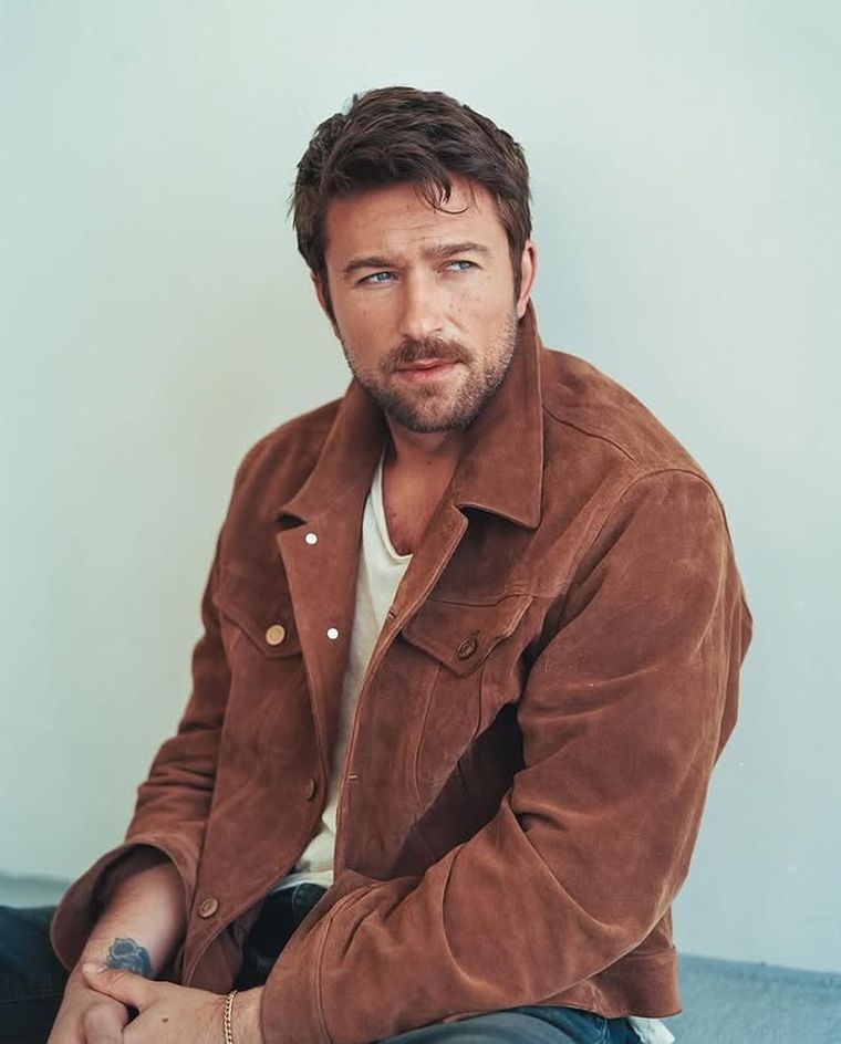 El accidente del actor no pasó a mayores y ya casi no es visible El accidente del actor no pasó a mayores y ya casi no es visible 