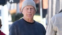 Que Ver | El preocupante estado de salud de  Bruce Willis.