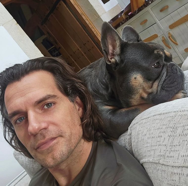 Henry Cavill recuperándose de la lesión. Henry Cavill recuperándose de la lesión.